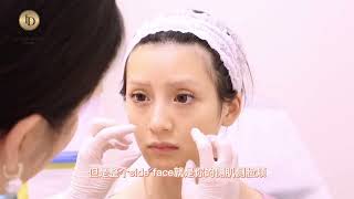 改变病弱刻薄感｜徐医生素人改造计划｜ID医美诊所 ID Cosmetic Clinic