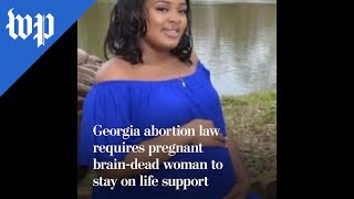Georgia law keeps brain-dead woman on life support for fetus