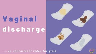 What is Vaginal discharge? ⏰ Different colours of vaginal discharge and what they mean