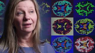 The Brain Initiative
