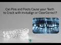 Pins and Posts and Severe Abfractions with Invisalign and ClearCorrect