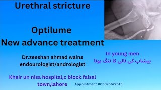#urethal stricture,new advance treatment.OPTILUME,LESS RECURRENCE