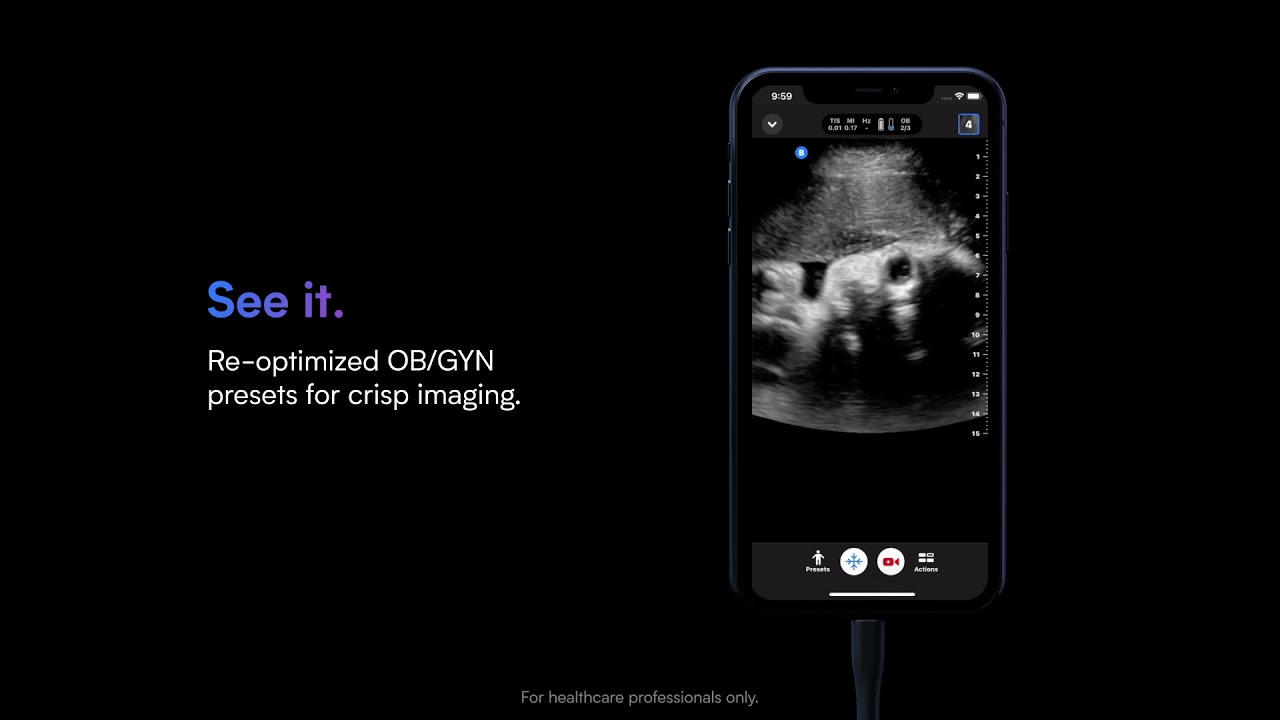 Butterfly OB/GYN Bedside Ultrasound - YouTube