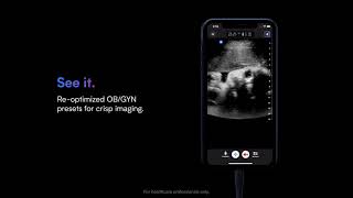 Butterfly OB/GYN Bedside Ultrasound