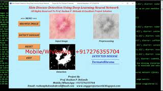 Skin Disease Detection Using Deep Learning Neural Network | Source Code Python OpenCV Project