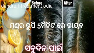 ଯେତେ ରୁପି ହେଇଥାଉ ଶାମ୍ପୋ ରେ ଏହାକୁ ମିଶାଇ ଲଗାନ୍ତୁ 5ମିନଟ ରେରୁପି ସଫା ସବୁଦିନ ପାଇଁ / dandruff removal odia