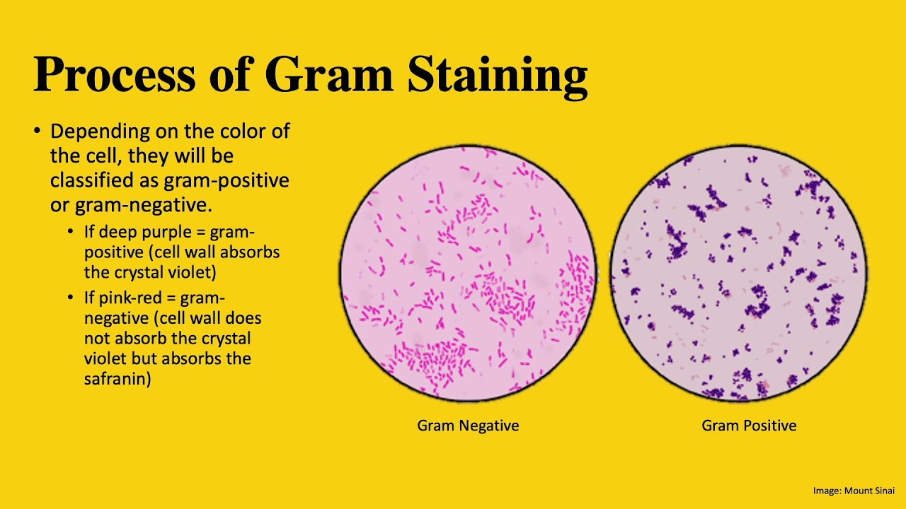 The Differences Between Gram-Positive And Gram-Negative Bacteria | MCAT ...