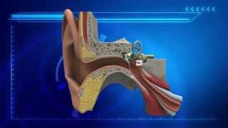 University of Kansas invents gene therapy to restore natural hearing
