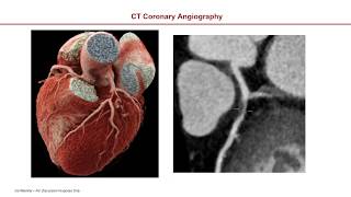 Cardiac Gating Editiing Techniques