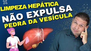 LIMPEZA HEPÁTICA NÃO EXPULSA PEDRA DA VESÍCULA (colelitíase). Limpeza hepática funciona ?