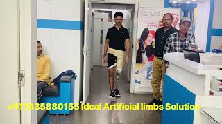 07835880155  From Jammu lost above knee | H1 / OH5 hydraulic knee joint | Prosthesis | just 3rd day