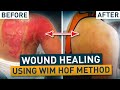 Progressive Wound Healing | Wim Hof Method Progressive Wound Healing | Wim Hof Method
