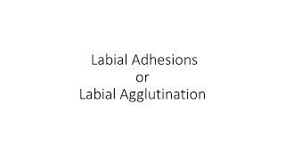 PERINEOCON 2018 | Labial Adhesions or Labial Agglutination by Dr Ajit Vaze