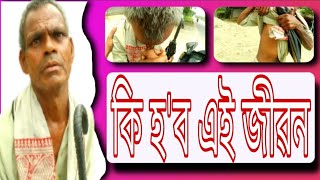 কি হ'ব এই জীৱন| টকাৰ অভাৱত চিকিৎসা হব পৰা নাই|supporthumanity |helpthepoor|emotional