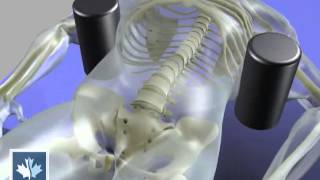 Sciatica | Spinal Decompression | Back Clinics of Canada