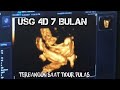 USG 4D Usia Kehamilan 28 MINGGU ( 7 BULAN ) #usg #shortsbeta #anakanak #usg4dimensi #hamil