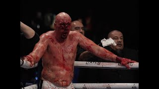 BLOODBATH Bare Knuckle WAR in the TRIGON ｜ East vs Rush ｜ Full Fight ｜ BYB 35