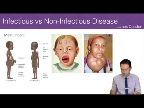 Infectious vs Non-Infectious Disease Infectious vs Non-Infectious Disease