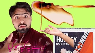 Impress Your Friends with This Finger Trick | Party Tricks / hero vlog