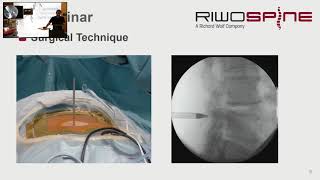 RIWOspine Alliance Webcast Part 4
