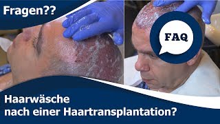 Wie erfolgt die Haarwäsche nach einer Haartransplantation? | Haartransplantation Türkei