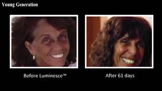 យូណេស កម្ពុជា Jeunesse Luminesce Before After Photos