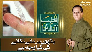 Hathon mein daanay nikalne ki kia waja | How to Get Rid of Warts on Palms |Qutb Online | SAMAA TV