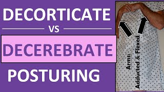 Decerebrate vs Decorticate Posturing Rigidity Mnemonic \u0026 Pictures Nursing NCLEX