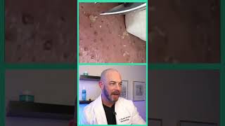 Derm reacts to BIG blackhead extractions! #dermreacts #doctorreacts #blackheads