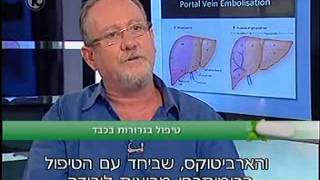 פרופ' קרסו | טיפול בגרורות בכבד