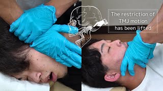 [ASMR chiro cracking]Full body adjustment, TMJ motion has been lifted, Cracking sounds is clear!