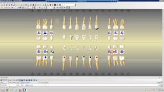 Dentrix Intro