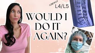 3 Years After Spine Surgery (L4/L5 Herniated Disc) Was It Worth It?