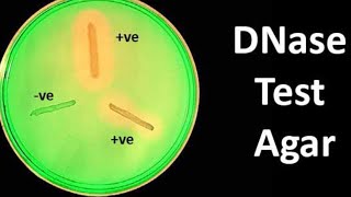 DNase Test: A Biochemical Test for identifications of DNase Producing Bacteria in Microbiology Lab