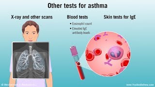 The Best Tools and Treatments for Severe Asthma