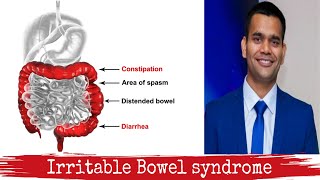 Definite Relief In Irritable Bowel Syndrome - IBS | Home Remedies And Natural Treatment