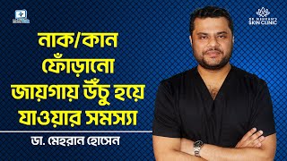 নাক কান ফোঁড়ানোর জায়গা উঁচু হয়ে যাওয়ার সমস্যা