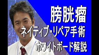 【女性泌尿器科】膀胱瘤のネイティブ・リペア手術について　（ホワイドボード解説）