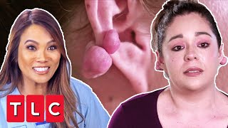 Dr Lee Helps Woman Remove Keloids That Have Been Holding Her Back | Dr Pimple Popper Pop Up