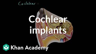 Cochlear implants | Processing the Environment | MCAT | Khan Academy