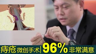 激光雷射痔疮手术知多点 (Laser Piles Treatment)︱影片包含了各种痔疮治疗方法 – 马来西亚外科专科医生