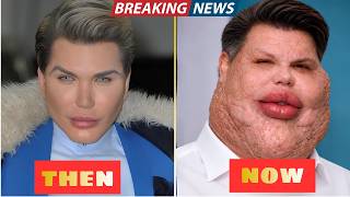 35 Stars Who Completely Ruined Their Faces With Plastic Surgery Disasters | Then and Now Photos 2026
