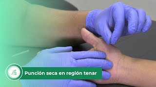 Punción seca en región tenar