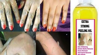 Yellow peeling oil Review In Bangla / ৩শেড ফর্সাকারী পিলিং ওয়েল।