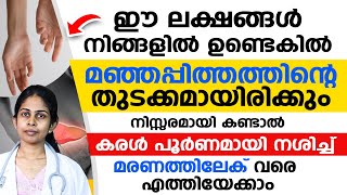 ഈ ലക്ഷണങ്ങൾ നിങ്ങളിൽ ഉണ്ടെകിൽ  മഞ്ഞപ്പിത്തത്തിന്റെ തുടക്കം മായിരിക്കും |manjapitham lakshanangal