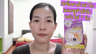 เซรั่มทาฝ้าลำไย JULA'S HERB ลดฝ้า ทดลองใช้เอง 7 วัน ใช้แล้วได้ผลเป็นไง |  iAmp Diary แม่แอม