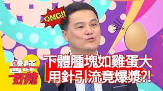 下體腫塊如雞蛋大！用針引流竟爆漿？醫師崩潰：噴到全身都是！【醫師好辣】20191114 part3 EP845 田知學 蔡逸姍