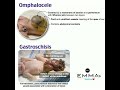 💠 omphalocele vs gastroschisis 💠