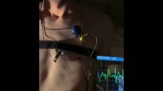 My heart freaking out ECG Full vid in description  #boy #heart #shirtless #visible #heartbeat  #ecg