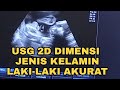 USG 2DIMENSI USIA KEHAMILAN 7 BULAN JENIS KELAMIN  LAKI - LAKI | dr. Agus Thoriq. SpOB